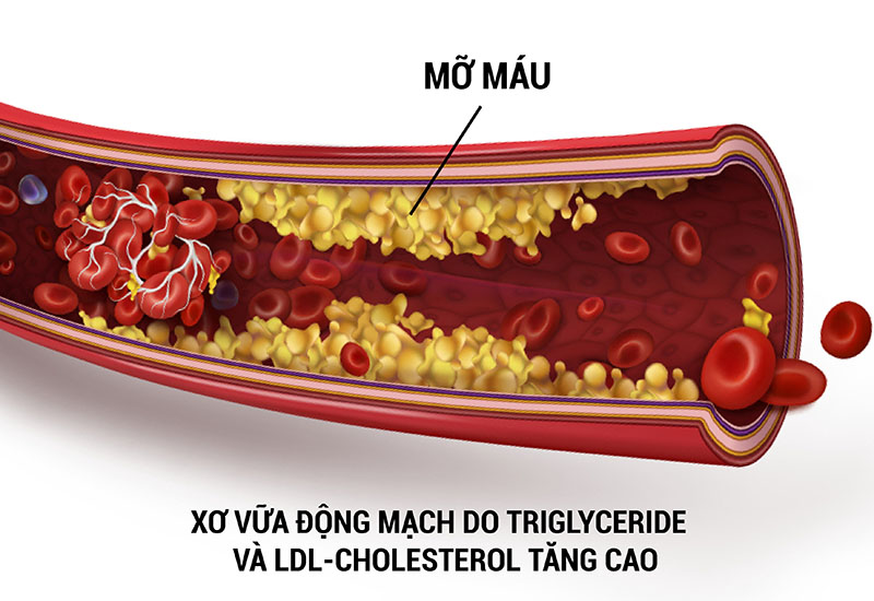 Cholesterol-la-gi